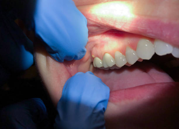 Best Emergency Dental Care for Trauma or Injury in Midway South, TX